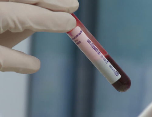 New Blood Test Developed to Diagnose Ovarian Cancer